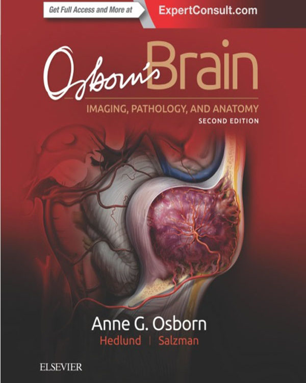 Osborn's Brain