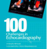 100 Challenges in Echocardiography