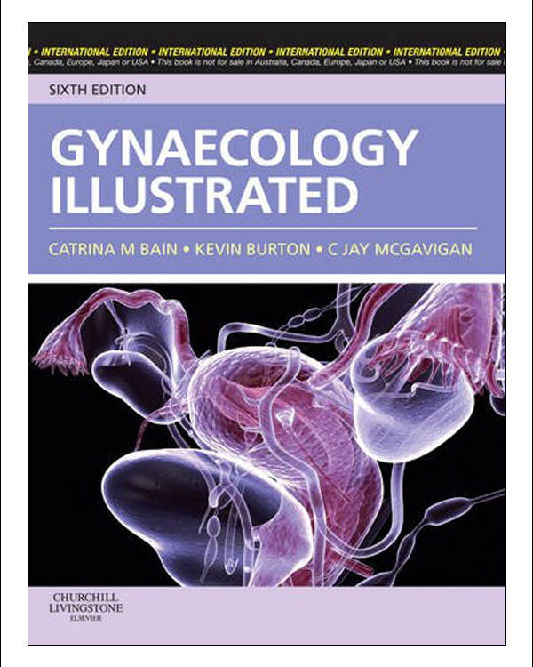 Gynaecology Illustrated