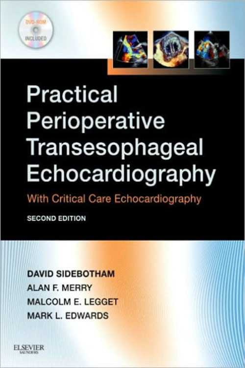 Practical Perioperative Transesophageal Echocardiography