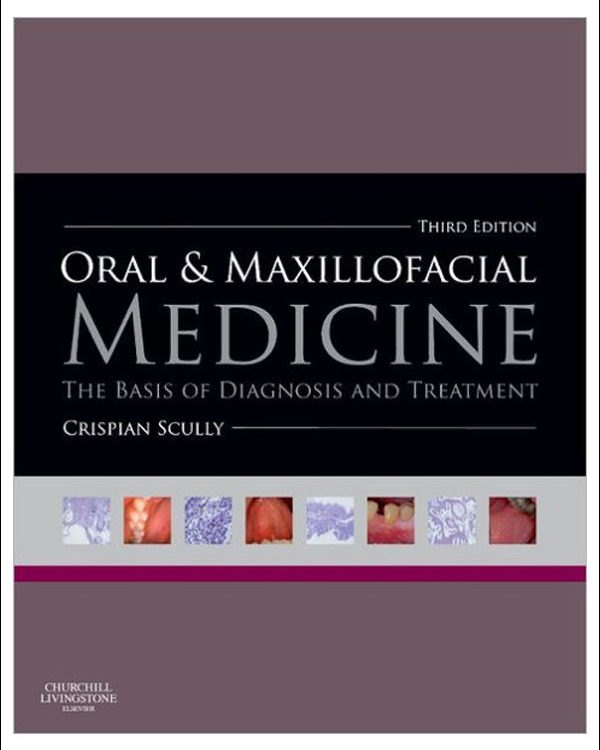 Oral and Maxillofacial Medicine