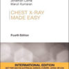 Chest X-Ray Made Easy, International Edition