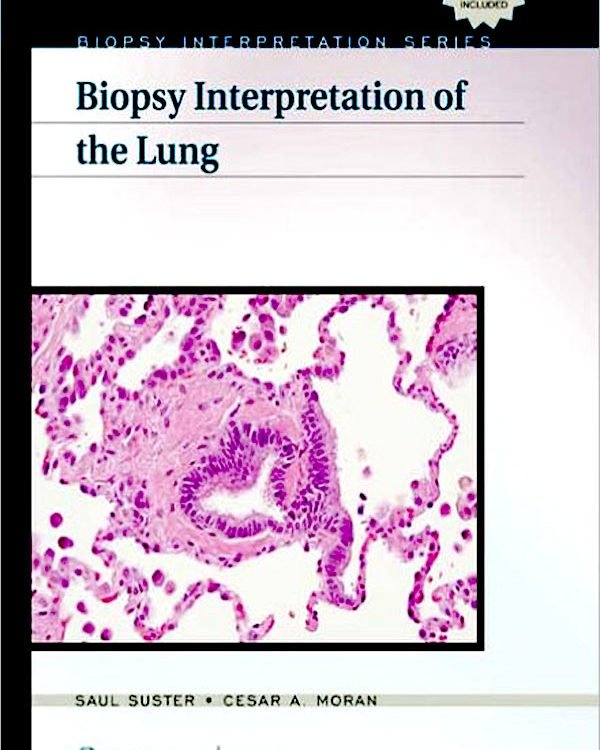 Biopsy Interpretation of the Lung