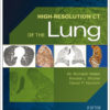 High-Resolution CT of the Lung