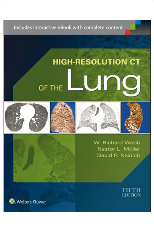 High-Resolution CT of the Lung