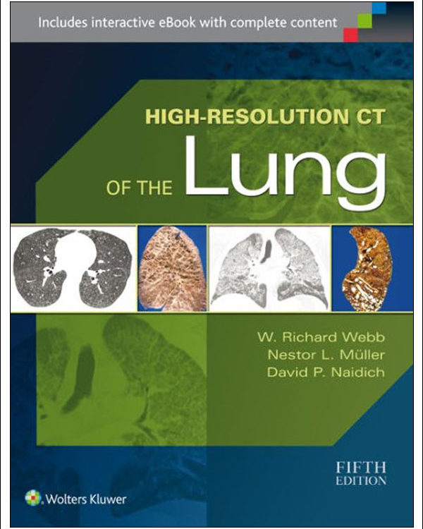 High-Resolution CT of the Lung