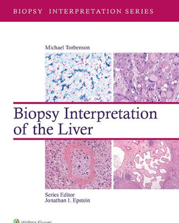 Biopsy Interpretation of the Liver