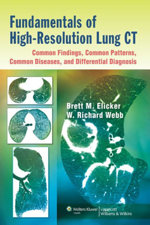 Fundamentals of High-Resolution Lung CT: Common Findings, Common Patterns, Common Diseases, and Differential Diagnosis: Common Findings, Common Patterns, Common Diseases, and Differential Diagnosis