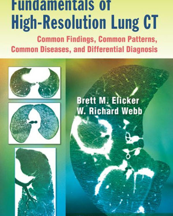Fundamentals of High-Resolution Lung CT: Common Findings, Common Patterns, Common Diseases, and Differential Diagnosis: Common Findings, Common Patterns, Common Diseases, and Differential Diagnosis