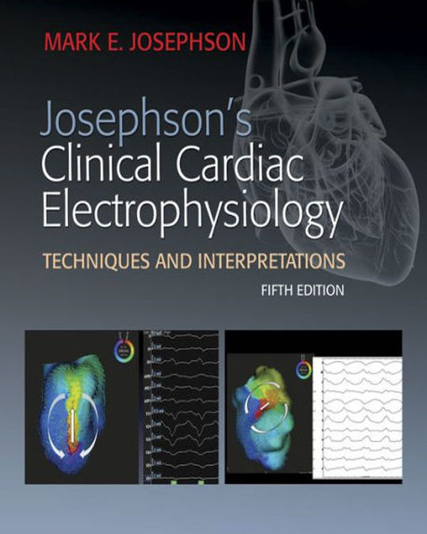 Josephson's Clinical Cardiac Electrophysiology