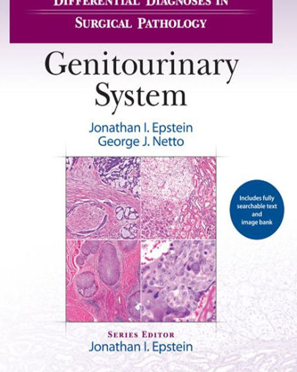 Differential Diagnoses in Surgical Pathology: Genitourinary System
