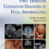 First Trimester Ultrasound Diagnosis of Fetal Abnormalities