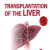 Transplantation of the Liver