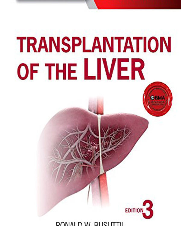 Transplantation of the Liver