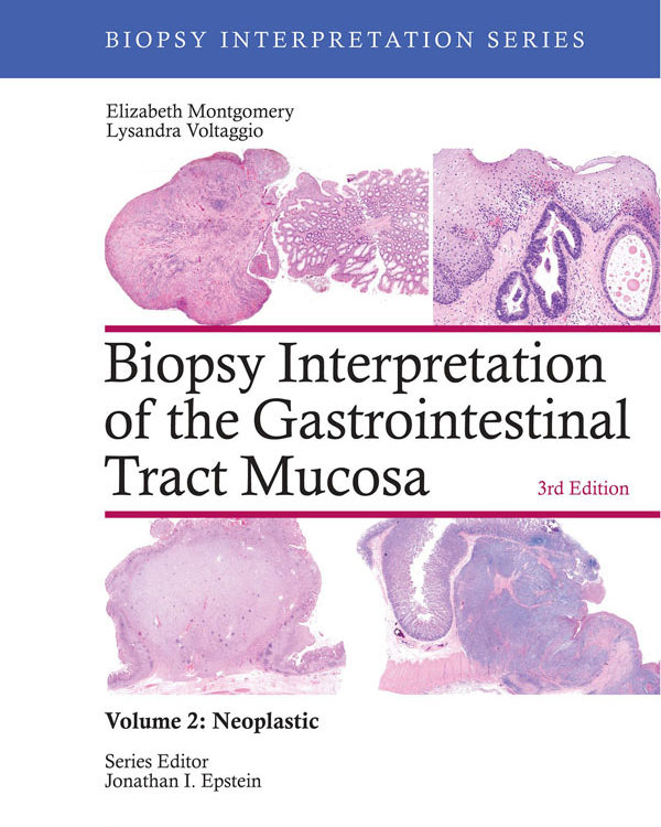 Biopsy Interpretation of the Gastrointestinal Tract Mucosa: Volume 2: Neoplastic