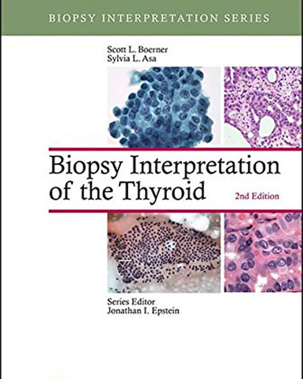 Biopsy Interpretation of the Thyroid