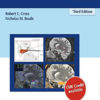 Neurosurgical Operative Atlas: Functional Neurosurgery