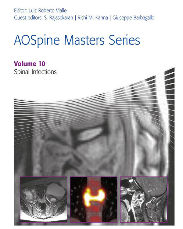 AOSpine Masters Series-Spinal Infections, Vol.10