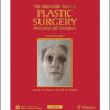 The Unfavorable Result in Plastic Surgery: Avoidance and Treatment