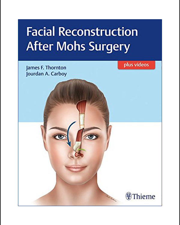 Facial Reconstruction After Mohs Surgery