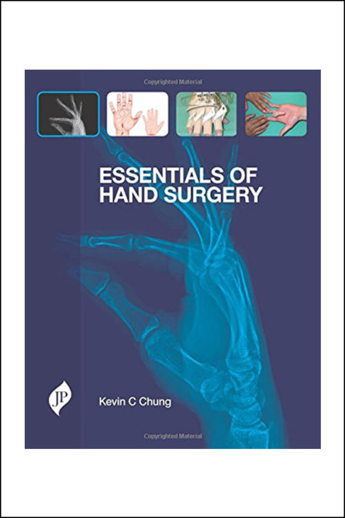 Essentials of Hand Surgery