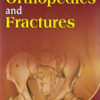 Outline of Orthopedics and Fractures