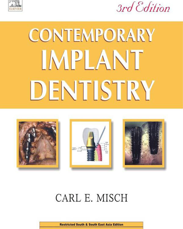 Contemporary Implant Dentistry