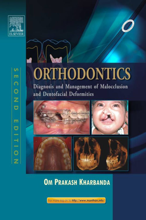 Orthodontics: Diagnosis of & Management of Malocclusion & Dentofacial Deformities