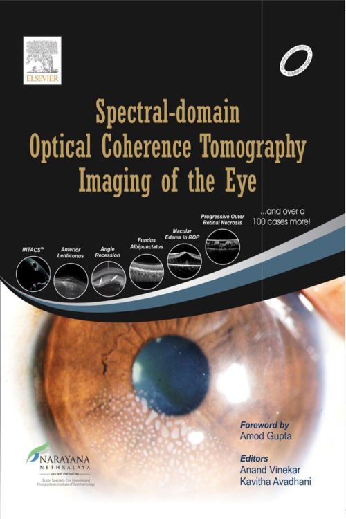 Spectral Domain Optical Coherence Tomography Imaging of the Eye