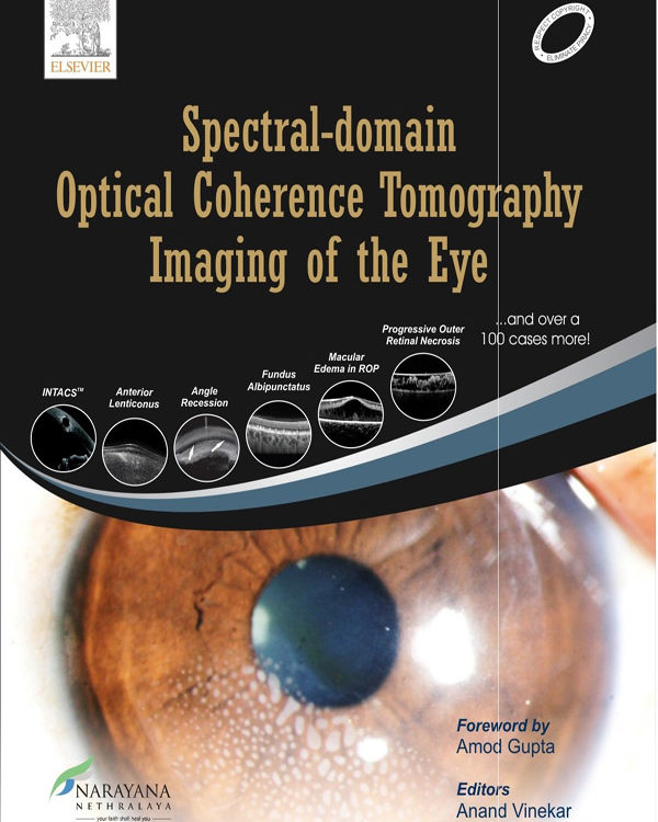 Spectral Domain Optical Coherence Tomography Imaging of the Eye