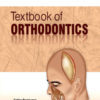 TEXTBOOK OF ORTHODONTICS
