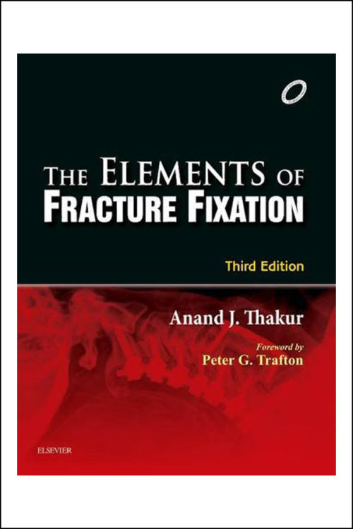 Elements of Fracture Fixation