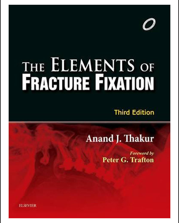 Elements of Fracture Fixation