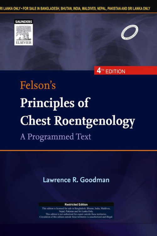 Felson's Principles of Chest Roentgenology, a Programmed Text