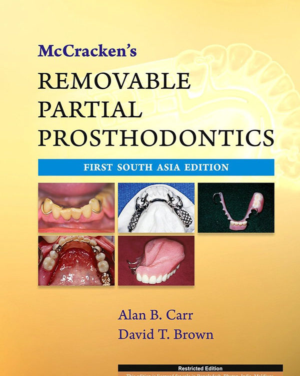 McCracken's Removable Partial Prosthodontics