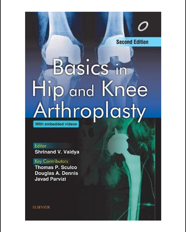 Basics in Hip and Knee Arthroplasty