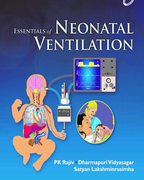 Essentials of Neonatal Ventilation