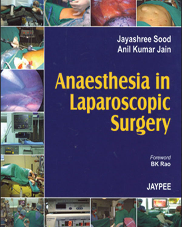 Anaesthesia in Laparoscopic Surgery