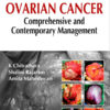 Ovarian Cancer Comprehensive and Contemporary Management