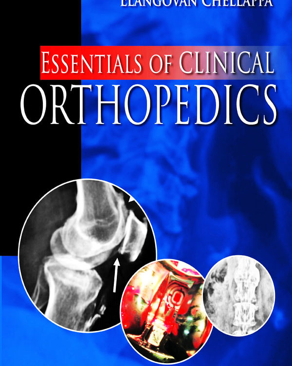 Essentials of Clinical Orthopedics