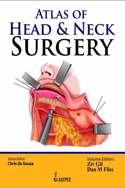 Atlas Of Head And Neck Surgery