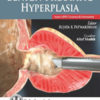 Common Urologic Problems Benign Prostatic Hyperplasia