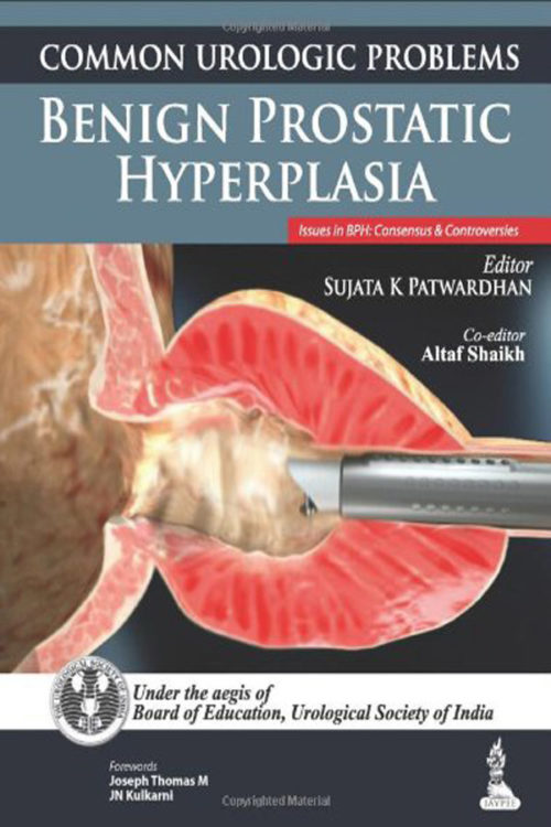 Common Urologic Problems Benign Prostatic Hyperplasia