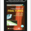 Handbook of Fractures