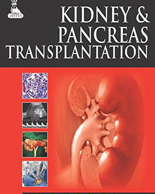 Kidney and Pancreas Transplantation