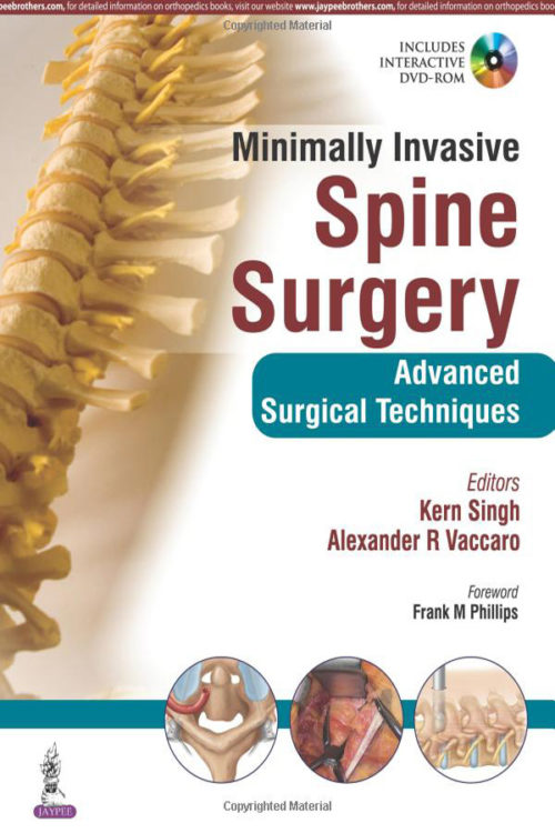 ​Minimally Invasive Spine Surgery