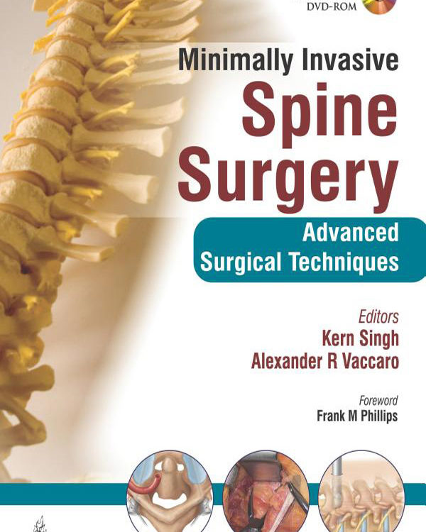​Minimally Invasive Spine Surgery