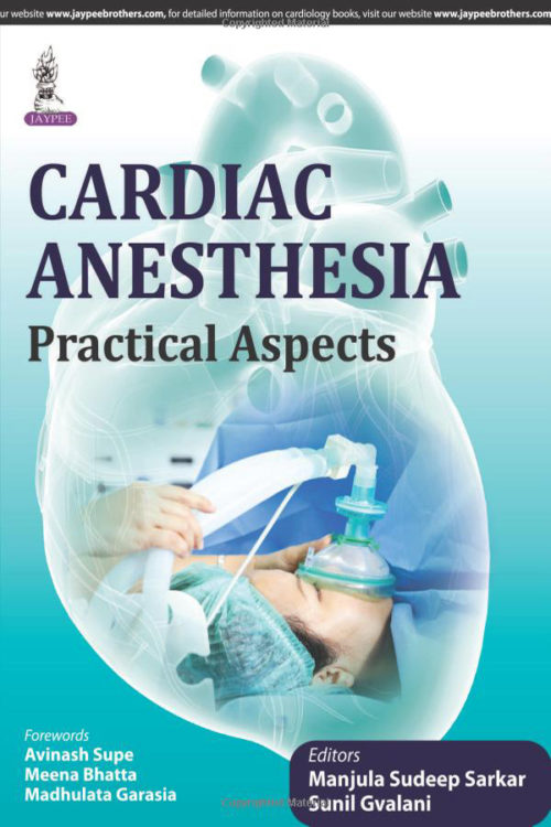 Cardiac Anesthesia Practical Aspects