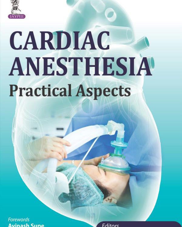 Cardiac Anesthesia Practical Aspects