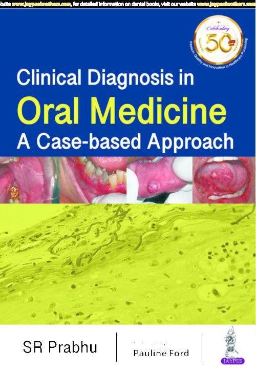 Clinical Diagnosis in ORAL MEDICINE A Case-based Approach 1st Edition 2019 